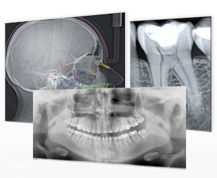 Ejemplos de radiografías odontológicas del folleto institucional de D.O.C.